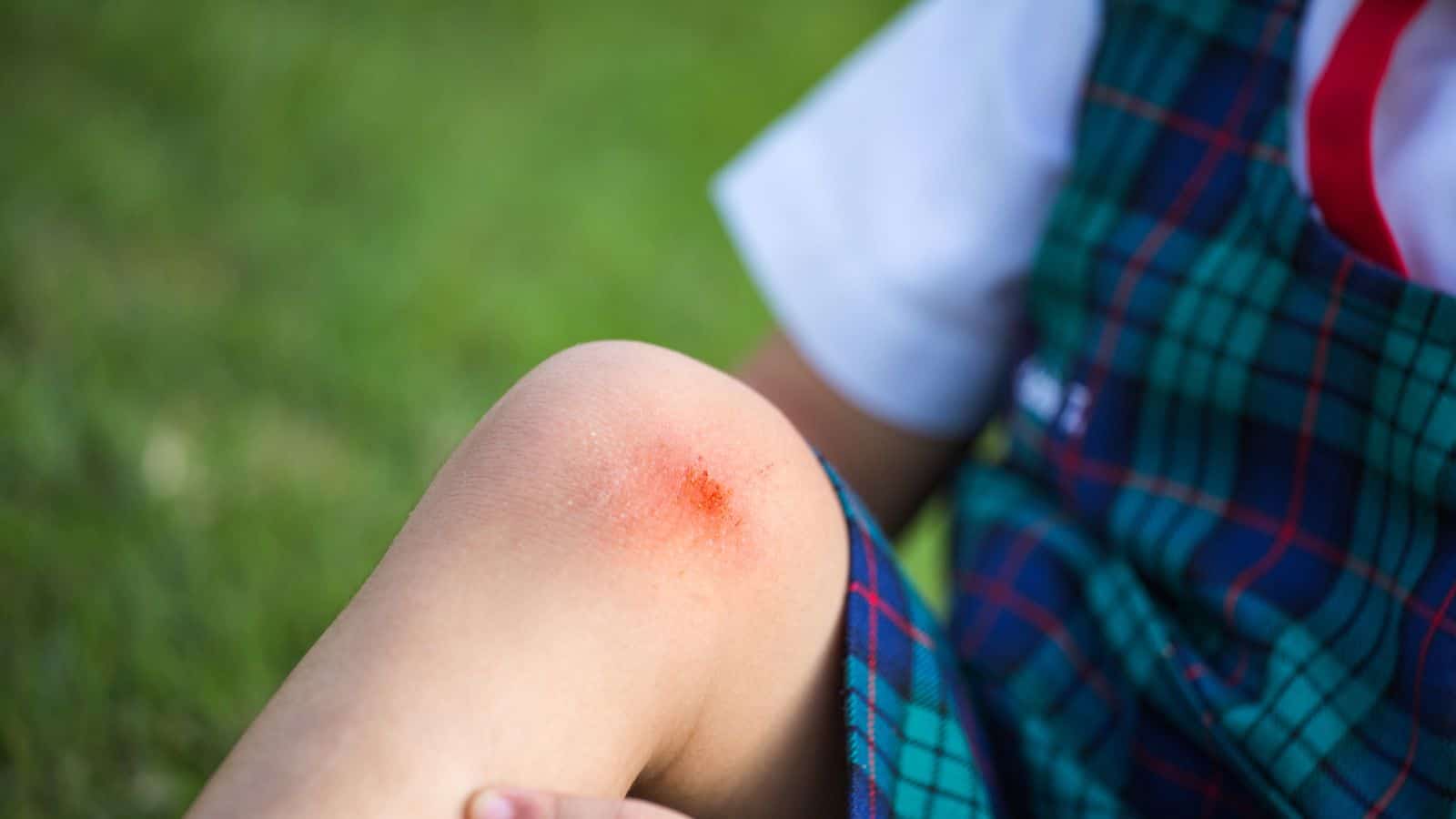 minor scrapes and wounds
